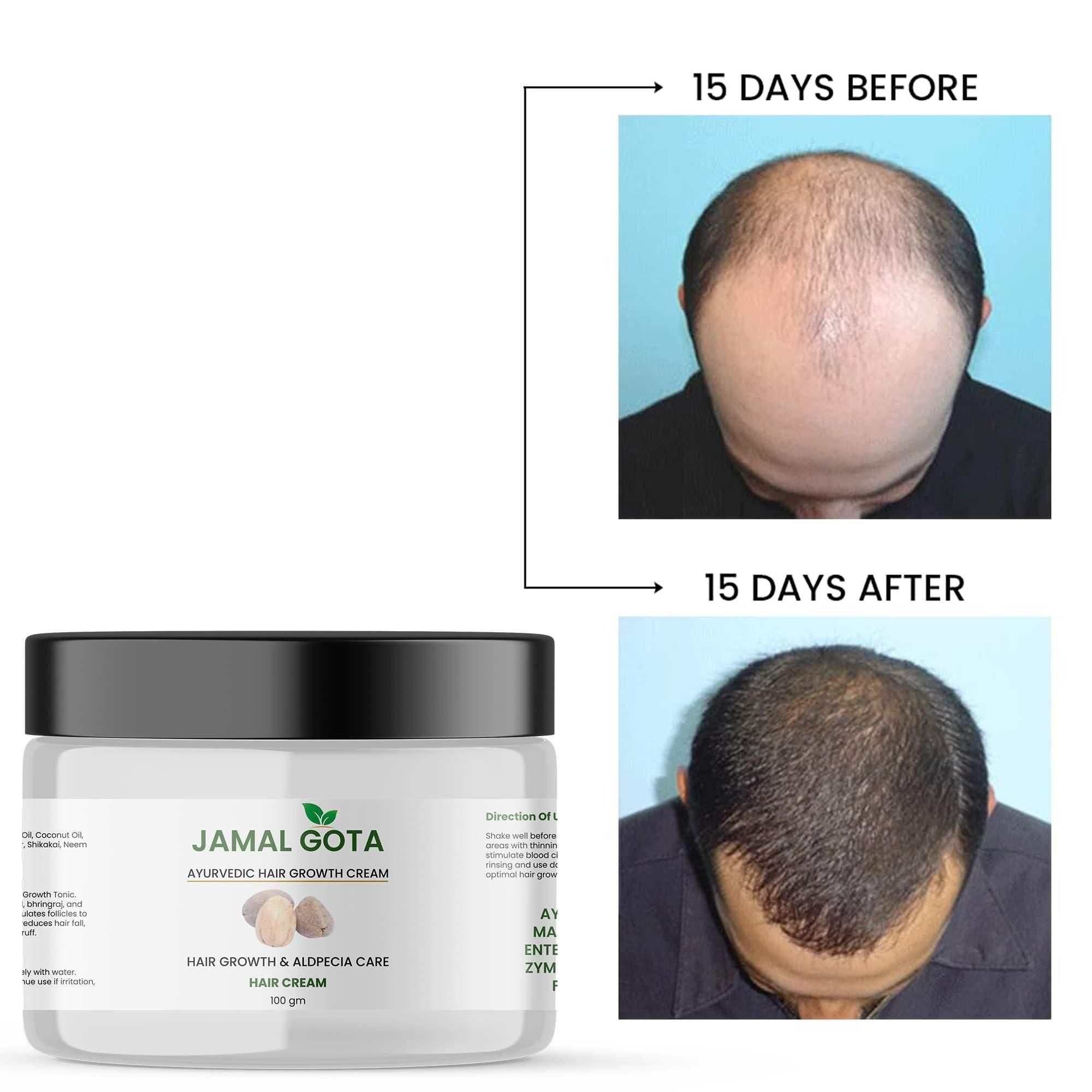 Jamalgota Ayurvedic Hair Growth Cream 100gm